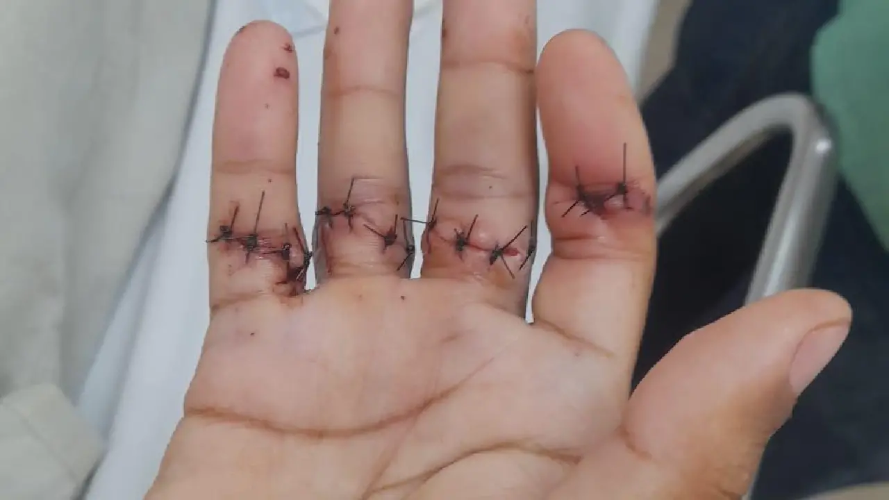 Aparecida de Goiânia: Homem sai com facão pelas ruas para atacar desconhecidos 