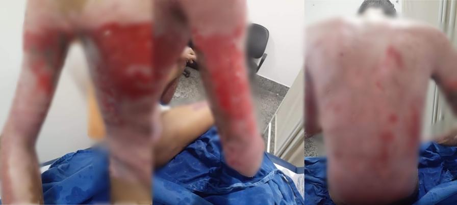 Sobrevivente de incêndio em uma empresa de reciclagens em Aparecida de Goiânia, pede ajuda para se alimentar