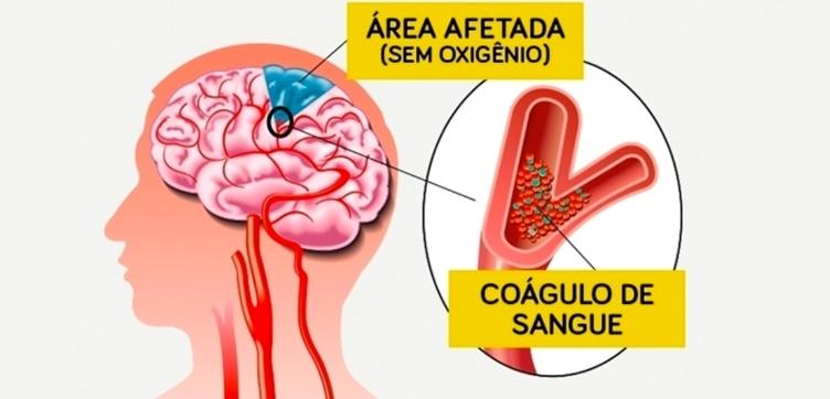Conheça os sintomas, causas e tratamentos para o problema que levou o Prefeito de Aparecida à internação