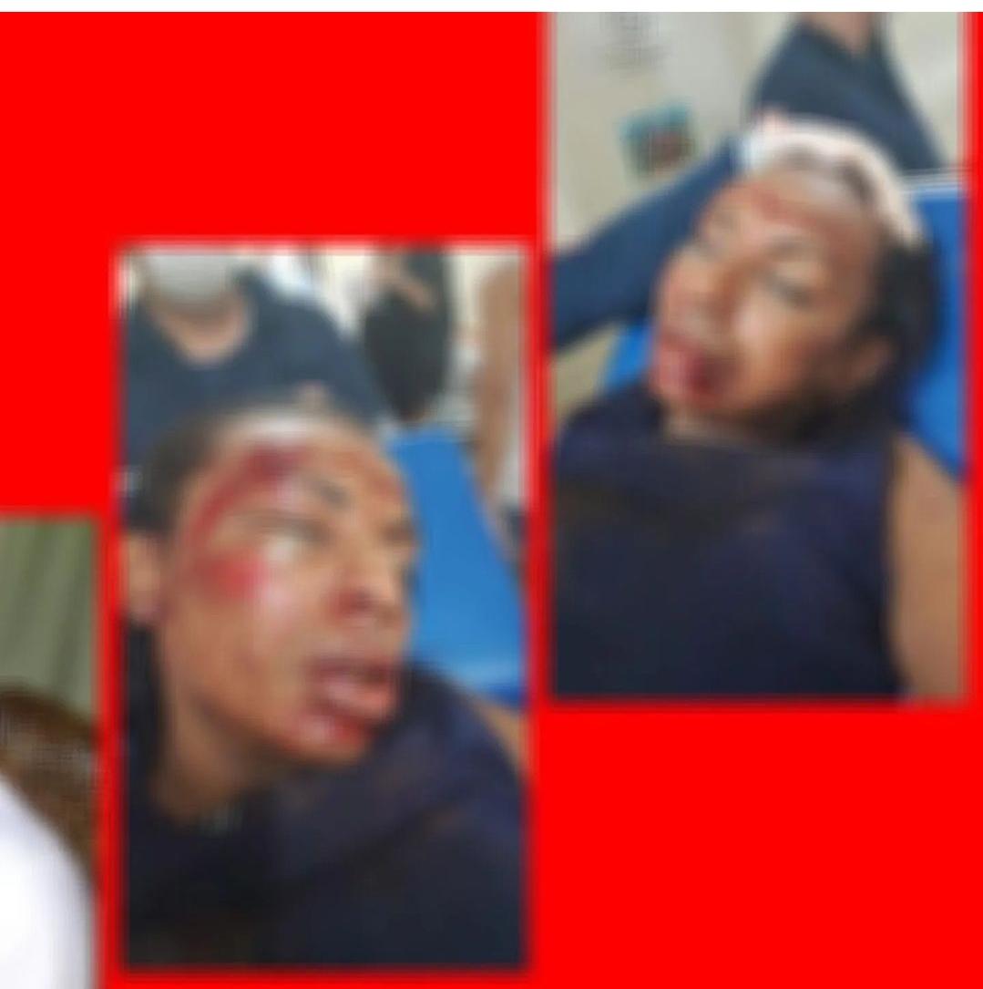 Trans sexual é agredida com pedaço de concreto, em Aparecida