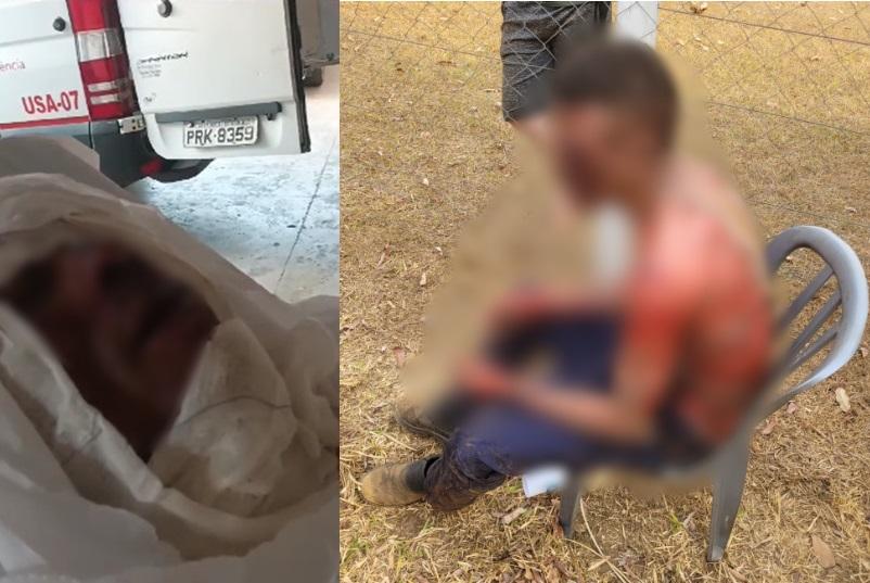 Homem relata que funcionários de supermercado de Aparecida jogaram álcool e atearam fogo em seu corpo