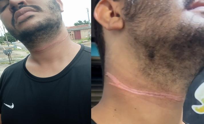 Motociclista é ferido no pescoço por fio caído em rua de Aparecida