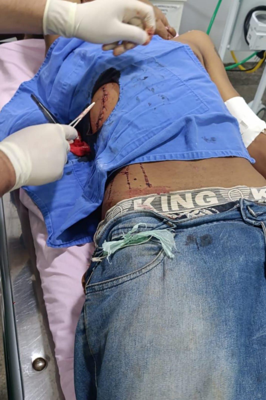 Justiça mantém prisão de homem que tentou matar rapaz em bar