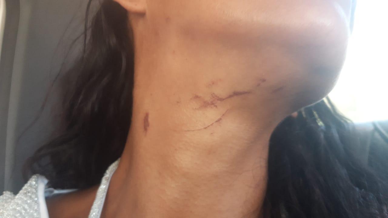 Suspeito de estuprar grávida é preso em Aparecida